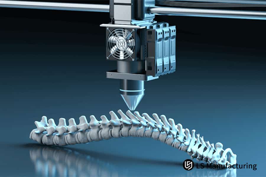 3D-печать полимерной анатомической модели с высоким разрешением для экономичного хирургического планирования и быстрого прототипирования на станках с ЧПУ.