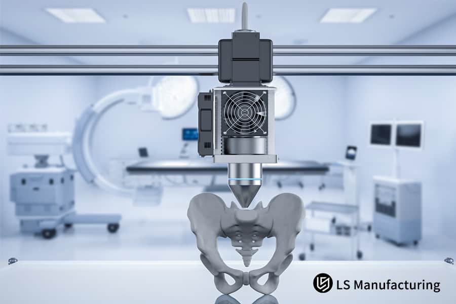 3D-печать точной полимерной модели тазовой кости для хирургического планирования и медицинского применения.